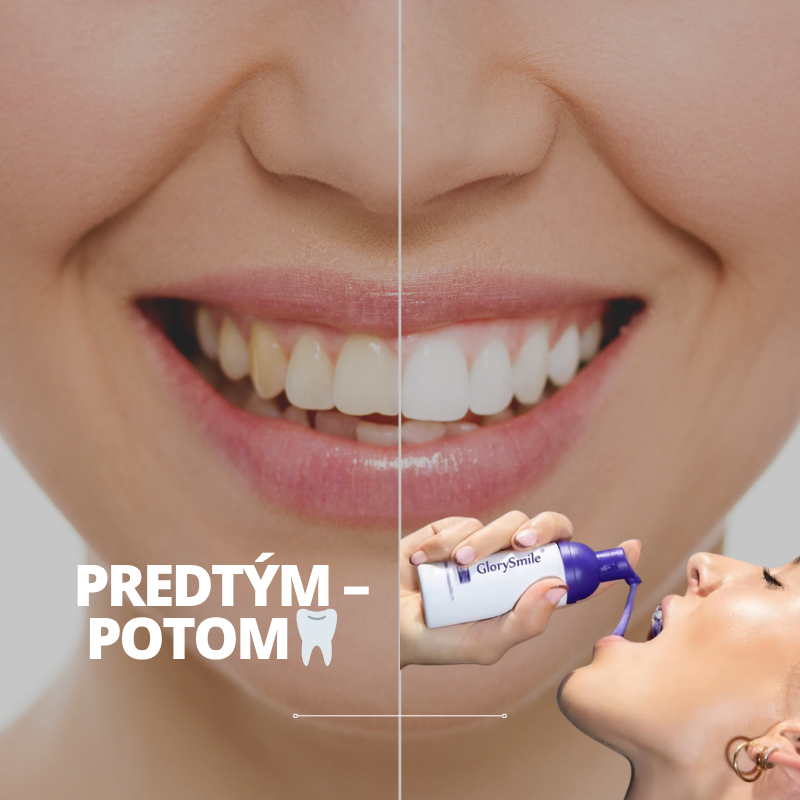 GlorySmile